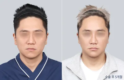 Before & After