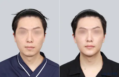 Before & After