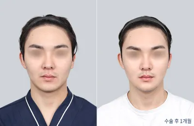 Before & After