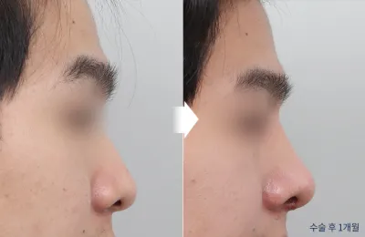 Before & After