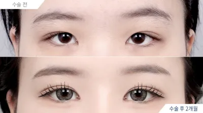 Before & After