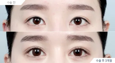 Before & After
