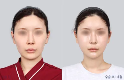 Before & After