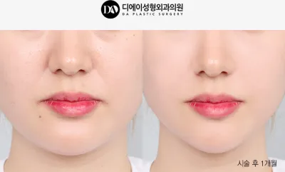 Before & After