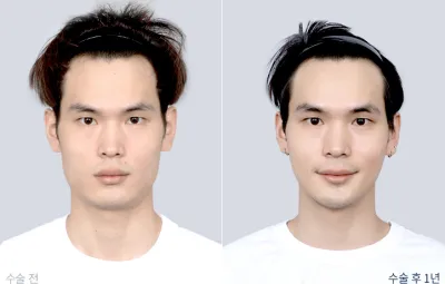 Before & After