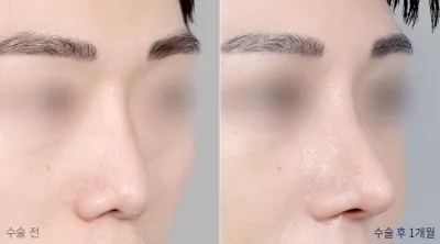 Before & After
