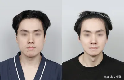 Before & After