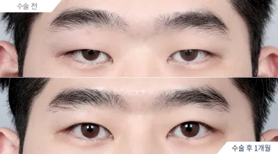 Before & After