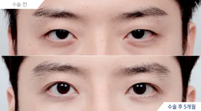 Before & After
