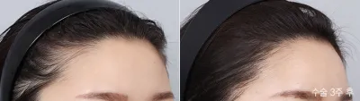 Before & After