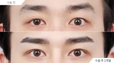 Before & After