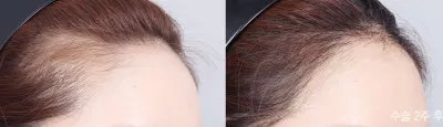 Before & After