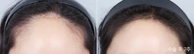 Before & After