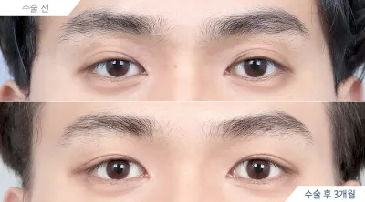 Before & After