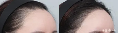 Before & After