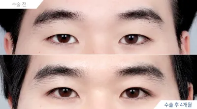Before & After