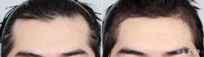 Before & After