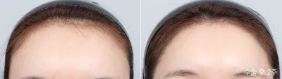 Before & After
