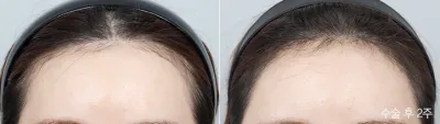 Before & After