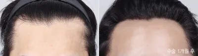 Before & After