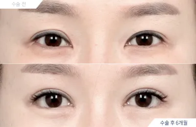 Before & After