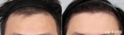 Before & After