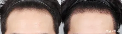 Before & After