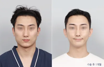 Before & After