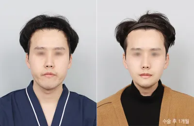 Before & After
