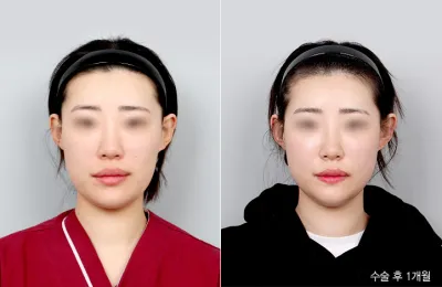 Before & After