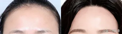 Before & After