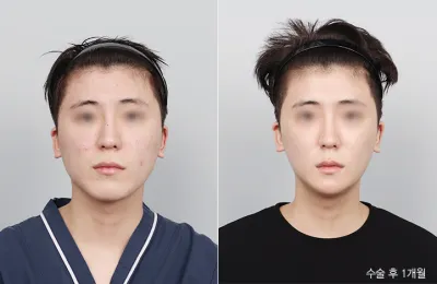 Before & After