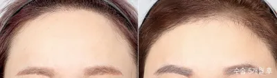 Before & After