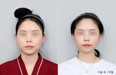 Before & After