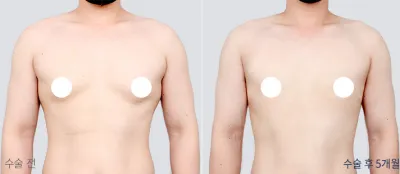 Before & After