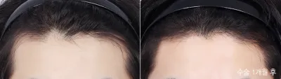 Before & After