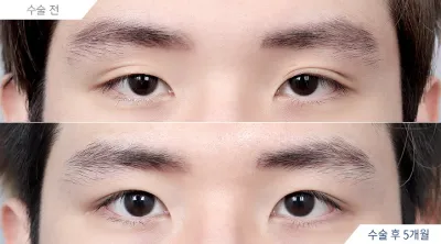 Before & After