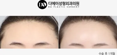 Before & After