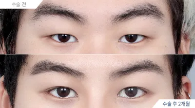 Before & After