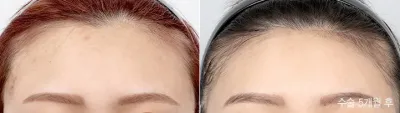 Before & After