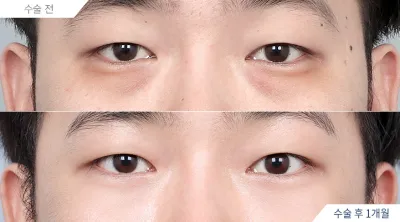 Before & After