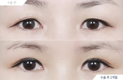 Before & After