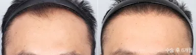 Before & After
