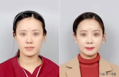 Before & After