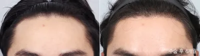 Before & After