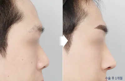 Before & After