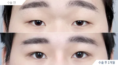 Before & After
