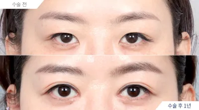 Before & After