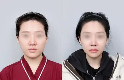 Before & After