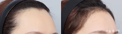 Before & After